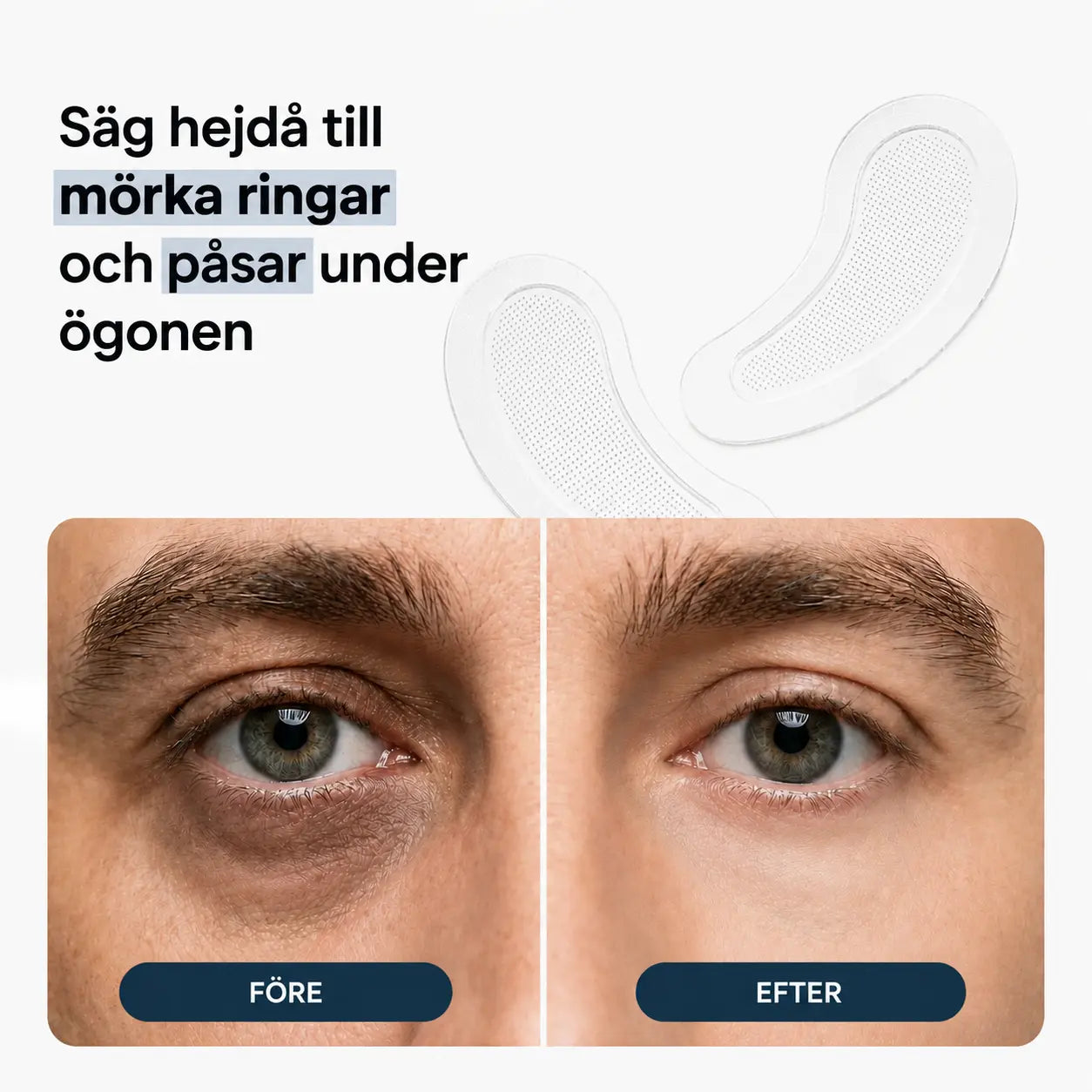 SCANDI – mikroneulalaastarit miehille